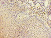 Immunohistochemistry of paraffin-embedded human tonsil tissue using CSB-PA822164ESR1HU at dilution of 1:100