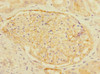 Immunohistochemistry of paraffin-embedded human kidney tissue using CSB-PA822164ESR1HU at dilution of 1:100