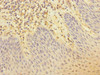 Immunohistochemistry of paraffin-embedded human tonsil tissue using CSB-PA822164ESR2HU at dilution of 1:100