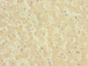 Immunohistochemistry of paraffin-embedded human liver tissue using CSB-PA005983ESR1HU at dilution of 1:100