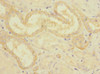 Immunohistochemistry of paraffin-embedded human kidney tissue using CSB-PA005983ESR1HU at dilution of 1:100