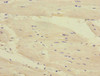 Immunohistochemistry of paraffin-embedded human heart tissue using CSB-PA007189ESR1HU at dilution of 1:100
