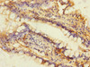 Immunohistochemistry of paraffin-embedded human small intestine tissue using CSB-PA007229ESR1HU at dilution of 1:100