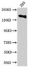 Western Blot<br />
 Positive WB detected in: 293 whole cell lysate<br />
 All lanes: DUOX2 antibody at 1:2000<br />
 Secondary<br />
 Goat polyclonal to rabbit IgG at 1/50000 dilution<br />
 Predicted band size: 176 kDa<br />
 Observed band size: 176 kDa<br />