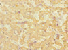 Immunohistochemistry of paraffin-embedded human liver tissue using CSB-PA007467ESR1HU at dilution of 1:100