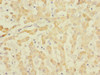 Immunohistochemistry of paraffin-embedded human liver tissue using CSB-PA007467ESR2HU at dilution of 1:100