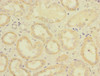 Immunohistochemistry of paraffin-embedded human kidney tissue using CSB-PA008542ESR1HU at dilution of 1:100