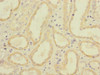 Immunohistochemistry of paraffin-embedded human kidney tissue using CSB-PA008542ESR2HU at dilution of 1:100