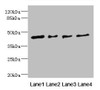 Western blot<br />
 All lanes: FCRL6 antibody at 1.29µg/ml<br />
 Lane 1: Hela whole cell lysate<br />
 Lane 2: A549 whole cell lysate<br />
 Lane 3: Jurkat whole cell lysate<br />
 Lane 4: HepG2 whole cell lysate<br />
 Secondary<br />
 Goat polyclonal to rabbit IgG at 1/10000 dilution<br />
 Predicted band size: 48, 46, 44, 35 kDa<br />
 Observed band size: 48 kDa<br />
