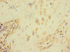 Immunohistochemistry of paraffin-embedded human placenta tissue using CSB-PA718779ESR2HU at dilution of 1:100