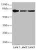 Western blot<br />
 All lanes: FZD3 antibody at 1.94µg/ml<br />
 Lane 1: THP-1 whole cell lysate<br />
 Lane 2: Hela whole cell lysate<br />
 Lane 3: HepG2 whole cell lysate<br />
 Secondary<br />
 Goat polyclonal to rabbit IgG at 1/10000 dilution<br />
 Predicted band size: 77 kDa<br />
 Observed band size: 77 kDa<br />