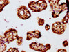 IHC image of CSB-PA882067ESR1HU diluted at 1:194 and staining in paraffin-embedded human placenta tissue performed on a Leica BondTM system. After dewaxing and hydration, antigen retrieval was mediated by high pressure in a citrate buffer (pH 6.0) . Section was blocked with 10% normal goat serum 30min at RT. Then primary antibody (1% BSA) was incubated at 4°C overnight. The primary is detected by a biotinylated secondary antibody and visualized using an HRP conjugated SP system.