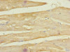 Immunohistochemistry of paraffin-embedded human skeletal muscle tissue using CSB-PA882067ESR2HU at dilution of 1:100