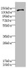 Western blot<br />
 All lanes: GRIN2D antibody IgG at 3.65µg/ml + HepG2 whole cell lysate<br />
 Secondary<br />
 Goat polyclonal to rabbit IgG at 1/10000 dilution<br />
 Predicted band size: 144 kDa<br />
 Observed band size: 144 kDa<br />