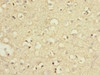 Immunohistochemistry of paraffin-embedded human brain tissue using CSB-PA618911ESR1HU at dilution of 1:100