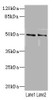 Western blot<br />
 All lanes: HTR3Bantibody at 3.29µg/ml<br />
 Lane 1: Mouse lung tissue<br />
 Lane 2: 293T whole cell lysate<br />
 Secondary<br />
 Goat polyclonal to rabbit IgG at 1/10000 dilution<br />
 Predicted band size: 51, 50 kDa<br />
 Observed band size: 51 kDa<br />