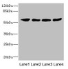 Western blot<br />
 All lanes: IFNLR1 antibody at 3.04µg/ml<br />
 Lane 1: Mouse kidney tissue<br />
 Lane 2: Mouse liver tissue<br />
 Lane 3: Human placenta tissue<br />
 Lane 4: Mouse lung tissue<br />
 Secondary<br />
 Goat polyclonal to rabbit IgG at 1/10000 dilution<br />
 Predicted band size: 58, 55, 24, 28 kDa<br />
 Observed band size: 58 kDa<br />