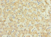 Immunohistochemistry of paraffin-embedded human liver tissue using CSB-PA882088ESR1HU at dilution of 1:100