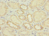 Immunohistochemistry of paraffin-embedded human kidney tissue using CSB-PA882088ESR1HU at dilution of 1:100