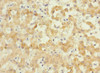 Immunohistochemistry of paraffin-embedded human liver tissue using CSB-PA882088ESR2HU at dilution of 1:100