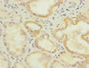 Immunohistochemistry of paraffin-embedded human kidney tissue using CSB-PA882088ESR2HU at dilution of 1:100