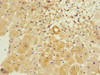 Immunohistochemistry of paraffin-embedded human heart tissue using CSB-PA891732ESR1HU at dilution of 1:100
