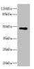 Western blot<br />
 All lanes: KIR3DL3 antibody at 1.75µg/ml + Jurkat whole cell lysate<br />
 Secondary<br />
 Goat polyclonal to rabbit IgG at 1/10000 dilution<br />
 Predicted band size: 45 kDa<br />
 Observed band size: 45 kDa<br />