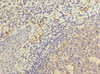 Immunohistochemistry of paraffin-embedded human tonsil tissue using CSB-PA850818ESR1HU at dilution of 1:100