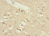 Immunohistochemistry of paraffin-embedded human brain tissue using CSB-PA013060ESR2HU at dilution of 1:100