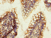 Immunohistochemistry of paraffin-embedded human small intestine tissue using CSB-PA013060ESR2HU at dilution of 1:100