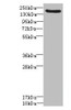 Western blot<br />
 All lanes: LY75 antibody IgG at 1.57µg/ml + Mouse liver tissue<br />
 Secondary<br />
 Goat polyclonal to rabbit IgG at 1/10000 dilution<br />
 Predicted band size: 199, 216, 20, 210 kDa<br />
 Observed band size: 199 kDa<br />