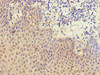 Immunohistochemistry of paraffin-embedded human tonsil tissue using CSB-PA013251ESR1HU at dilution of 1:100