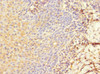 Immunohistochemistry of paraffin-embedded human tonsil tissue using CSB-PA013251ESR2HU at dilution of 1:100