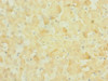 Immunohistochemistry of paraffin-embedded human liver tissue using CSB-PA015960ESR1HU at dilution of 1:100