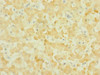 Immunohistochemistry of paraffin-embedded human liver tissue using CSB-PA015960ESR2HU at dilution of 1:100