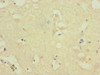 Immunohistochemistry of paraffin-embedded human brain tissue using CSB-PA015960ESR2HU at dilution of 1:100