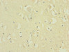 Immunohistochemistry of paraffin-embedded human brain tissue using CSB-PA347832ESR2HU at dilution of 1:100