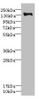 Western blot<br />
 All lanes: PLXNB2 antibody IgG at 2.39µg/ml + Mouse liver tissue<br />
 Secondary<br />
 Goat polyclonal to rabbit IgG at 1/10000 dilution<br />
 Predicted band size: 205 kDa<br />
 Observed band size: 205 kDa<br />