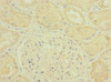 Immunohistochemistry of paraffin-embedded human kidney tissue using CSB-PA018223ESR1HU at dilution of 1:100