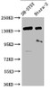 Western blot<br />
 All lanes: ROBO2 antibody IgG at 1.43µg/ml + Mouse liver tissue<br />
 Secondary<br />
 Goat polyclonal to rabbit IgG at 1/10000 dilution<br />
 Predicted band size: 152, 131, 154 kDa<br />
 Observed band size: 152 kDa<br />