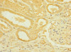 Immunohistochemistry of paraffin-embedded human kidney tissue using CSB-PA888028ESR1HU at dilution of 1:100