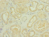 Immunohistochemistry of paraffin-embedded human kidney tissue using CSB-PA888028ESR2HU at dilution of 1:100