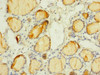 Immunohistochemistry of paraffin-embedded human thyroid tissue using CSB-PA885761ESR1HU at dilution of 1:100