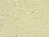 Immunohistochemistry of paraffin-embedded human brain tissue using CSB-PA885761ESR1HU at dilution of 1:100