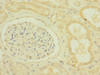 Immunohistochemistry of paraffin-embedded human kidney tissue using CSB-PA2108ESR1HU at dilution of 1:100