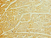 Immunohistochemistry of paraffin-embedded human heart tissue using CSB-PA2108ESR1HU at dilution of 1:100
