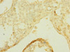 Immunohistochemistry of paraffin-embedded human testis tissue using CSB-PA021746ESR1HU at dilution of 1:100