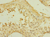Immunohistochemistry of paraffin-embedded human testis tissue using CSB-PA021746ESR2HU at dilution of 1:100