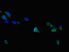 Immunofluorescent analysis of 293 cells using CSB-PA863139ESR1HU at dilution of 1:100 and Alexa Fluor 488-congugated AffiniPure Goat Anti-Rabbit IgG (H+L)