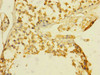 Immunohistochemistry of paraffin-embedded human testis tissue using CSB-PA023453ESR1HU at dilution of 1:100